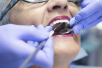 美研究称老年女性患牙龈疾病过早死亡风险增12%